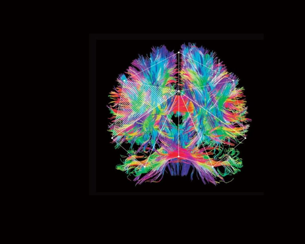 Brain illustration